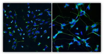 Ageing in the Human Brain: A Focus on Neuroprotection and Healthy Ageing